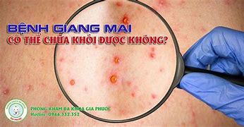 Mai An Giang Có Mưa Không